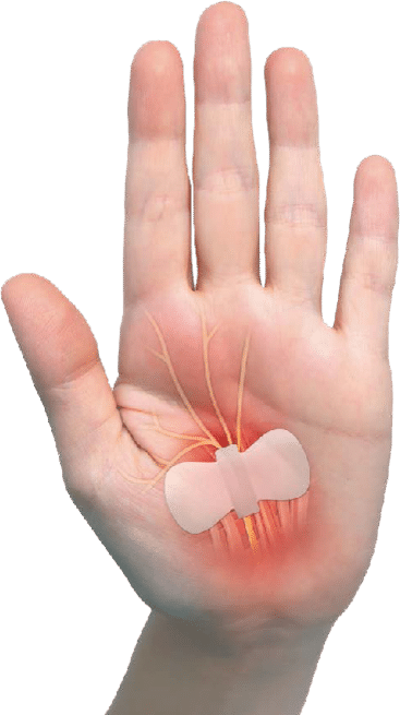 Carpal Aid - Image 5
